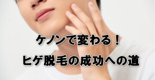 ケノンで変わる！ヒゲ脱毛の成功への道